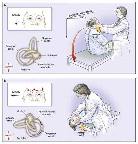 Vertigo In the Orthopedic Setting 